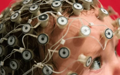 تحریک الکتریکی مغز با tDCS