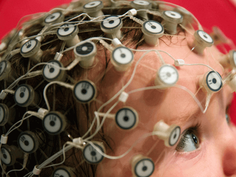 تحریک الکتریکی مغز با tDCS